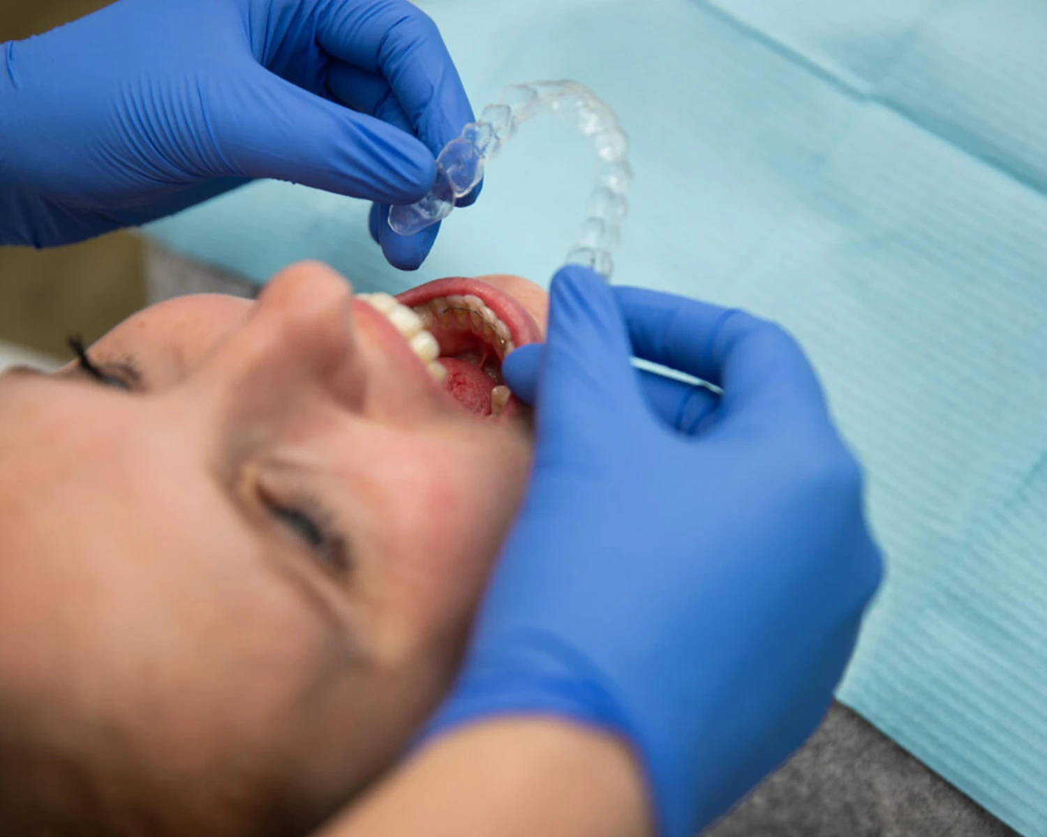 SureSmile beugel en patiënt