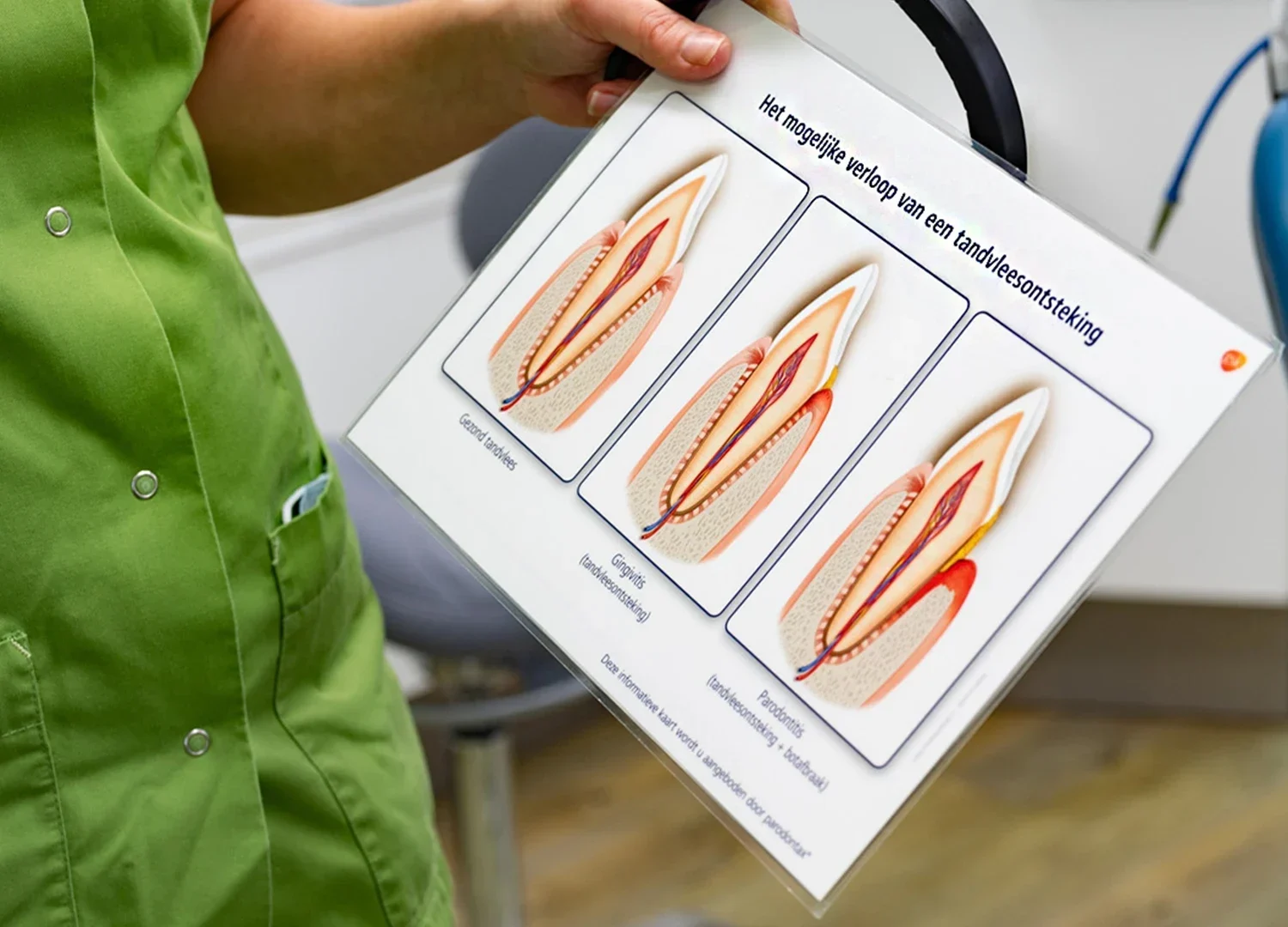 Instructies tandvleesontsteking